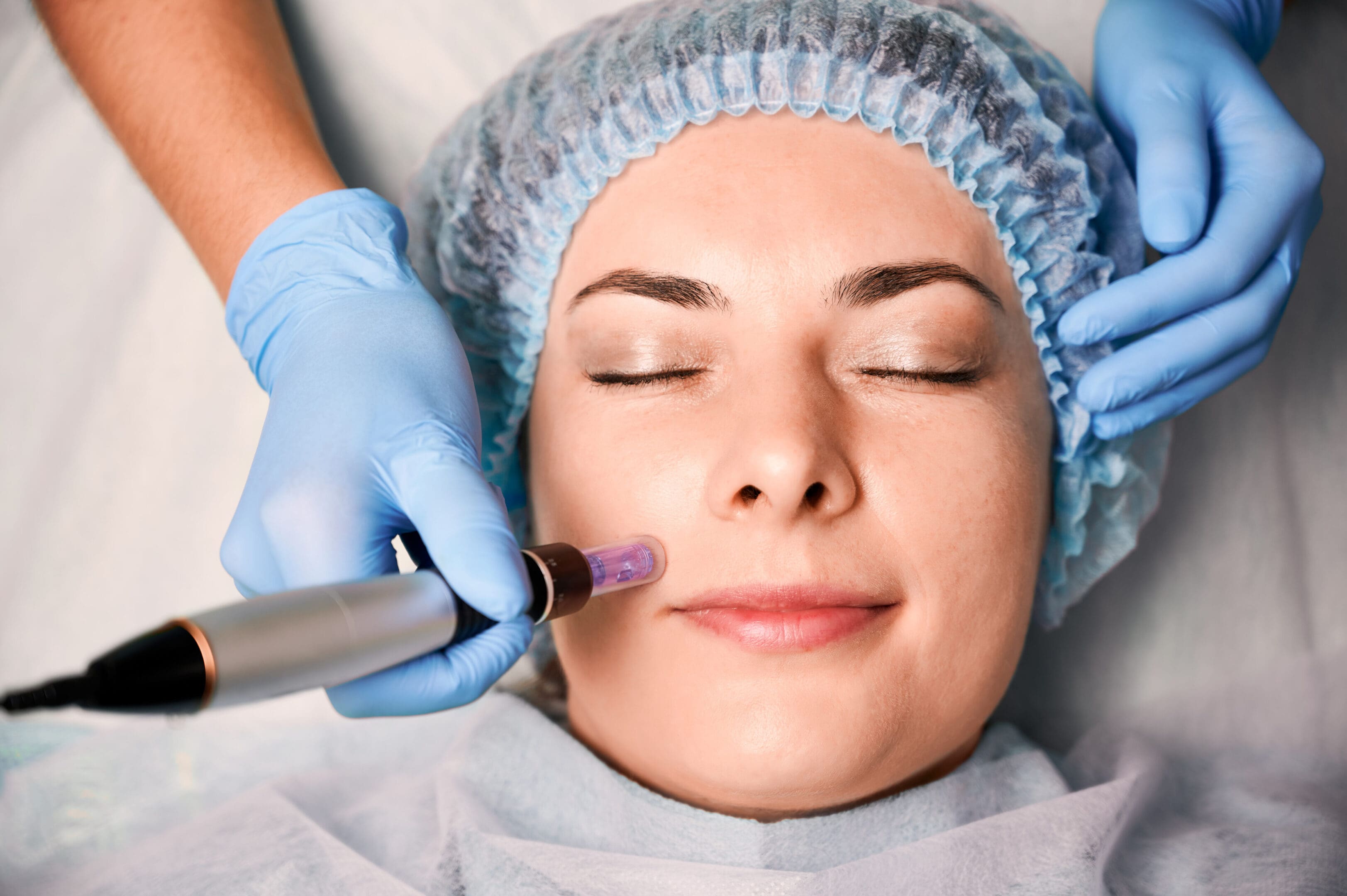 Close up of beautician hands in sterile gloves using dermapen during skincare procedure. Young woman receiving facial treatment in beauty salon. Concept of skincare and collagen induction therapy.